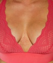 HKM:11